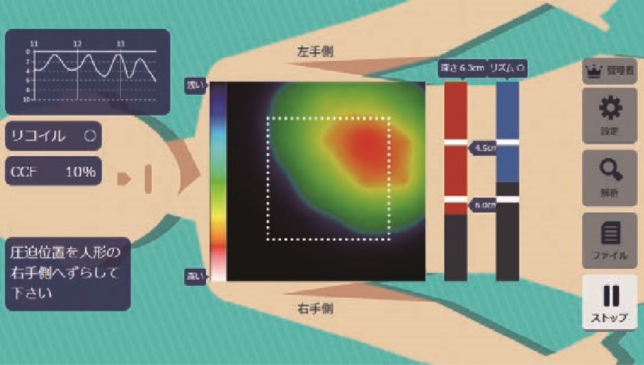 SR無線化ユニットの特徴2