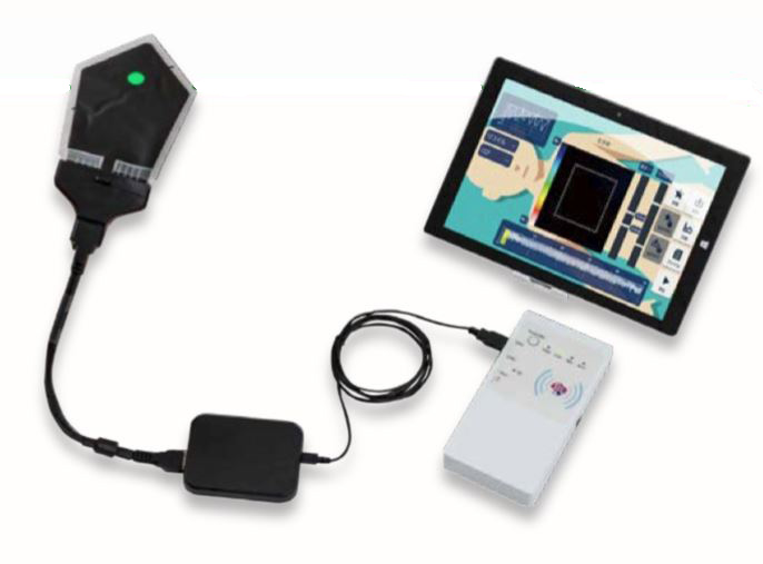 SR無線化ユニットの特徴1